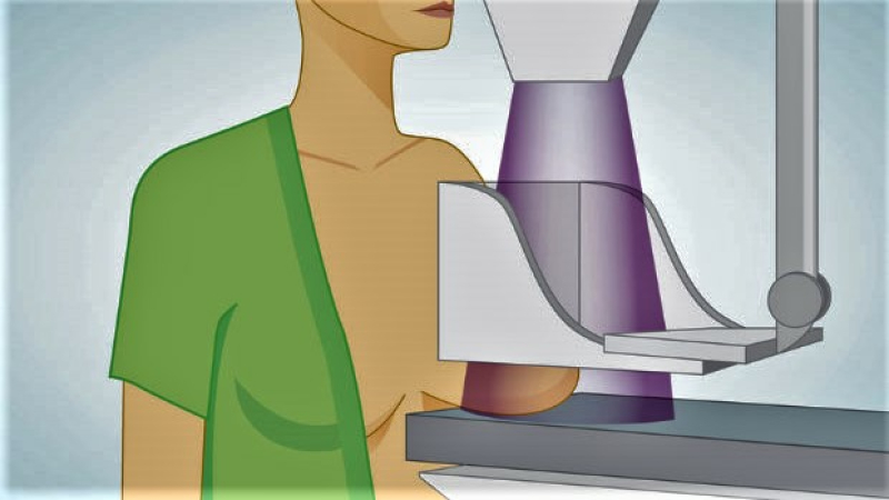 Fondation du Crédit Agricole Pyrénées Gascogne :20 000€ pour le mammographe de l'hôpital